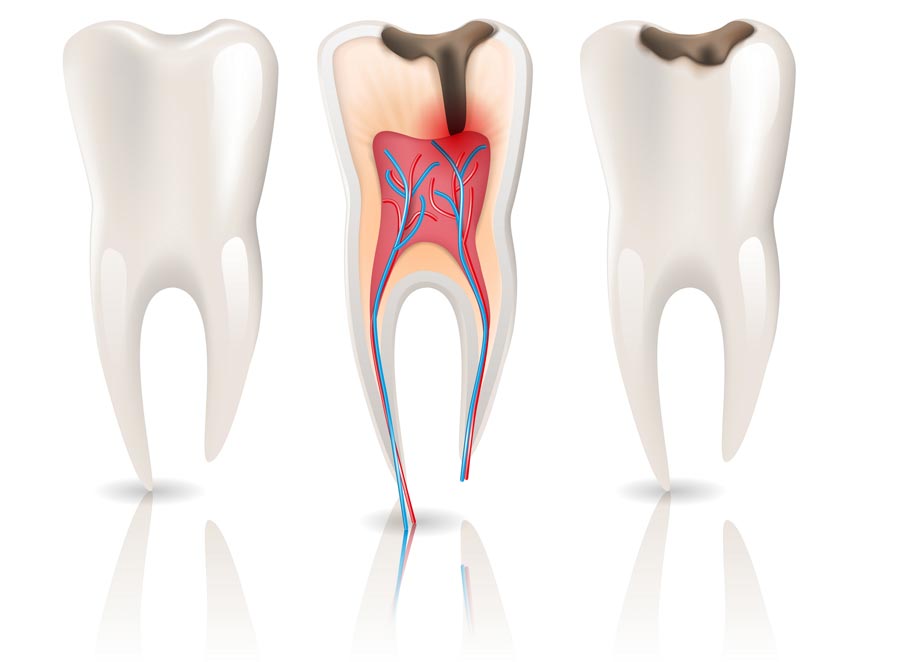 Endodontie
